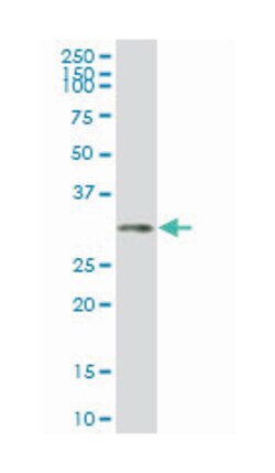 homeobox C4, Mouse, Clone: 2D6, Abnova 100&mu;g; Unlabeled:Antibodies,