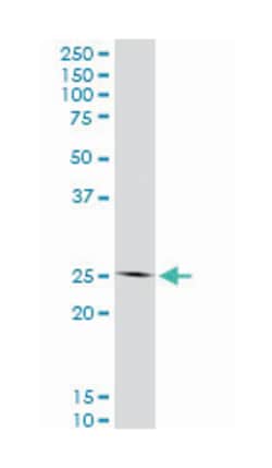 homeobox C12, Mouse, Clone: 1C6, Abnova 100&mu;g; Unlabeled:Antibodies,