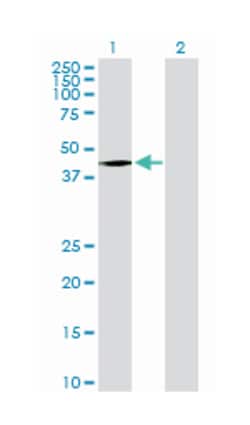 homeobox D8, Rabbit, Purified MaxPab Polyclonal Antibody, Abnova 100&mu;g;