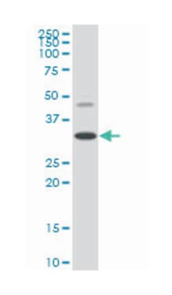 homeobox D8, Mouse, Clone: 3G8, Abnova 100 &mu;g | Buy Online | Abnova | Fisher Scientific