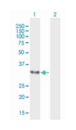 HP, Mouse, Purified MaxPab Polyclonal Antibody, Abnova 50&mu;g; Unlabeled:Antibodies,