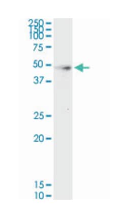 hepsin, Mouse, Clone: 2D5, Abnova 100&mu;g; Unlabeled:Antibodies, Monoclonal
