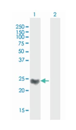 v-Ha-ras Harvey rat sarcoma viral oncogene homolog, Mouse, Polyclonal Antibody,