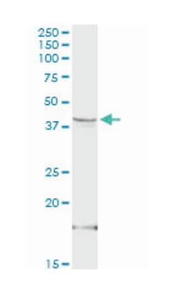 hydroxy-delta-5-steroid dehydrogenase, 3 beta- and steroid delta-isomerase 1, Rabbit, Purified MaxPab™ Polyclonal Antibody, Abnova™