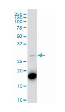 phenylethanolamine N-methyltransferase (A01), Mouse anti-Human, Polyclonal