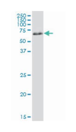 PRKAA1, Mouse, Clone: 3B6, Abnova 100 &mu;g | Buy Online | Abnova Corporation | Fisher Scientific