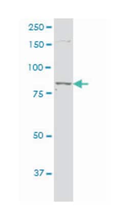 protein kinase C, epsilon, Mouse, Polyclonal Antibody, Abnova 50&mu;L;