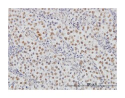 mitogen-activated protein kinase kinase 3, Mouse, Clone: 1D10, Abnova 100&mu;g;