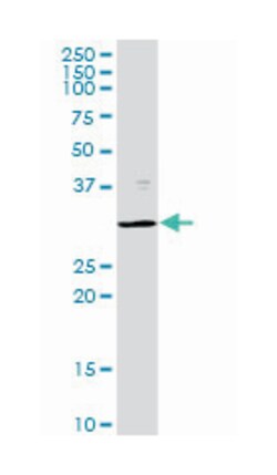 proteasome (prosome, macropain) subunit, beta type, 8 (large multifunctional