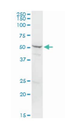 proteasome (prosome, macropain) 26S subunit, non-ATPase, 5, Rabbit, Purified