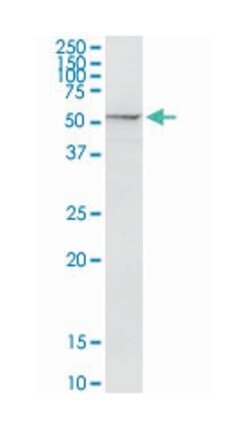proteasome (prosome, macropain) 26S subunit, non-ATPase, 5, Rabbit, Purified