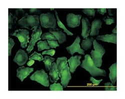 PTK7 protein tyrosine kinase 7, Mouse, Clone: 4F5, Abnova 100&mu;g; Unlabeled:Antibodies,