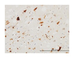 pleiotrophin, Mouse, Clone: 2E3, Abnova 100&mu;g; Unlabeled:Antibodies,