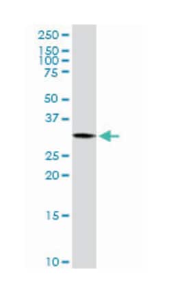 pyrroline-5-carboxylate reductase 1, Rabbit, Purified MaxPab Polyclonal Antibody, Abnova 100 &mu;g | Buy Online | Abnova Corporation | Fisher Scientific
