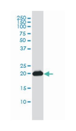 RAP2B, Mouse, Clone: 4F12-3C6, Abnova 100&mu;g; Unlabeled:Antibodies, Monoclonal