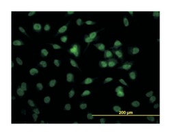 retinoblastoma binding protein 4, Mouse, Clone: 4A5, Abnova 100&mu;g; Unlabeled:Antibodies,