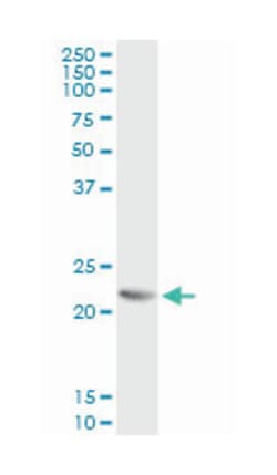 RCV1, Mouse, Clone: 3G10, Abnova 200&mu;L; Unlabeled:Antibodies, Monoclonal
