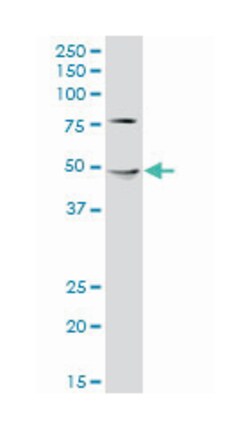 renin binding protein, Mouse, Polyclonal Antibody, Abnova 50&mu;L; Unlabeled:Anticuerpos