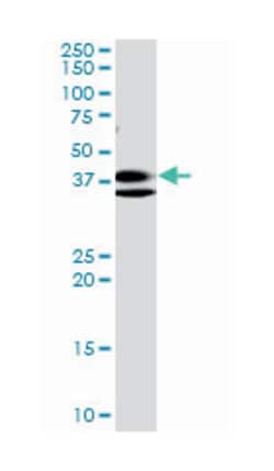 ring finger protein 2, Mouse, Clone: 6C2, Abnova 100 &mu;g | Buy Online | Abnova Corporation | Fisher Scientific