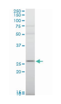 ribosomal protein S9, Mouse, Polyclonal Antibody, Abnova 50&mu;L; Unlabeled:Antibodies,