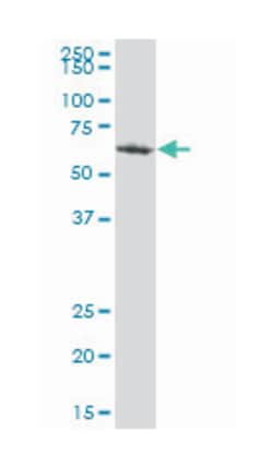 rhotekin, Mouse, Polyclonal Antibody, Abnova 50&mu;L; Unlabeled:Antibodies,