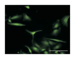 S100 calcium binding protein A7 (D03P), Rabbit anti-Human, Purified MaxPab Polyclonal Antibody, Abnova 100 &mu;g | Buy Online | Abnova | Fisher Scientific