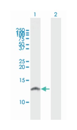 S100 calcium binding protein A8, Mouse, Polyclonal Antibody, Abnova 50&mu;L;