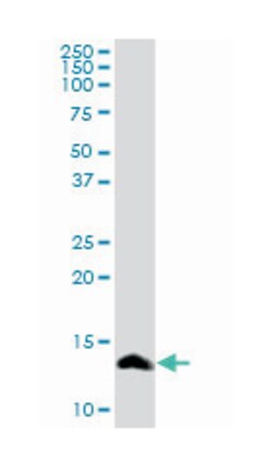 serum amyloid A4, constitutive, Rabbit, Purified MaxPab Polyclonal Antibody, Abnova 100 &mu;g | Buy Online | Abnova Corporation | Fisher Scientific