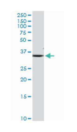 SDHB, Rabbit, Purified MaxPab Polyclonal Antibody, Abnova 100&mu;g; Unlabeled:Antibodies,