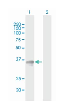 SGCG, Mouse, Polyclonal Antibody, Abnova 50&mu;g; Unlabeled:Antibodies,