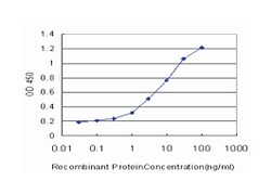 serum/glucocorticoid regulated kinase 1, Mouse, Clone: 3E3, Abnova 100 &mu;g | Buy Online | Abnova Corporation | Fisher Scientific
