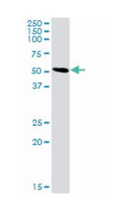solute carrier family 3 (activators of dibasic and neutral amino acid transport), member 2, Rabbit, Purified MaxPab™ Polyclonal Antibody, Abnova™