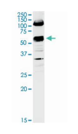 solute carrier family 3 (activators of dibasic and neutral amino acid transport),
