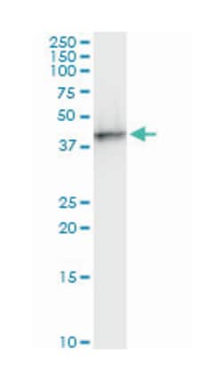 SWI/SNF related, matrix associated, actin dependent regulator of chromatin, subfamily b, member 1, Mouse, Clone: 3E3, Abnova™
