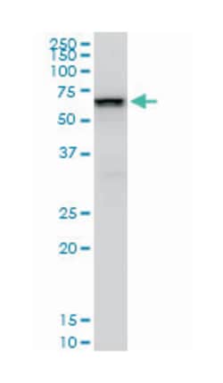 SWI/SNF related, matrix associated, actin dependent regulator of chromatin,