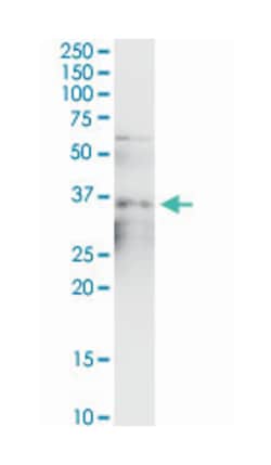 anti-SMN2 Ab-1, MaxPab Polyclonal, Abnova 100&mu;L; Unlabeled:Antibodies,