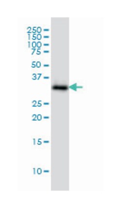 anti-SMN2, Clone: 2B11-2A9, Abnova 100 &mu;g | Buy Online | Abnova Corporation | Fisher Scientific