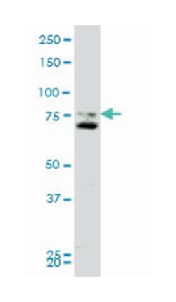 smoothened homolog (Drosophila), Mouse, Clone: 1D9, Abnova 100&mu;g; Unlabeled:Antibodies,