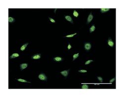 small nuclear RNA activating complex, polypeptide 4, 190kDa, Mouse, Clone: 1D1, Abnova 100 &mu;g | Buy Online | Abnova Corporation | Fisher Scientific