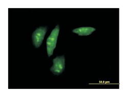 SFRS protein kinase 2, Mouse, Purified MaxPab Polyclonal Antibody, Abnova 50 &mu;g | Buy Online | Abnova | Fisher Scientific
