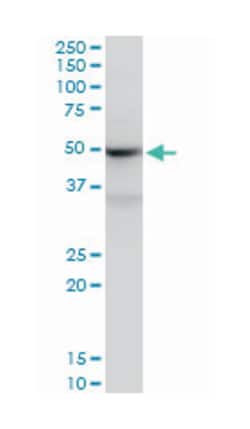 Sjogren syndrome antigen B (autoantigen La), Mouse, Polyclonal Antibody, Abnova 50 &mu;L | Buy Online | Abnova Corporation | Fisher Scientific