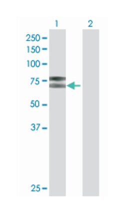 interleukin 2 receptor, beta, Mouse, Polyclonal Antibody, Abnova 50&mu;L;