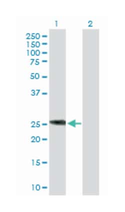 interleukin 6 (interferon, beta 2) (D03P), Rabbit anti-Human, Purified MaxPab™ Polyclonal Antibody, Abnova™
