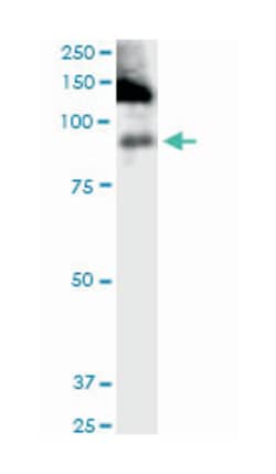 ITGB2, Mouse, Clone: 3C7, Abnova 100 &mu;g | Buy Online | Abnova Corporation | Fisher Scientific