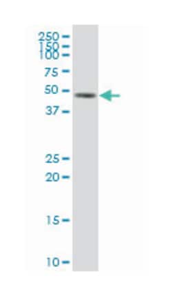 potassium inwardly-rectifying channel, subfamily J, member 11, Mouse, Polyclonal