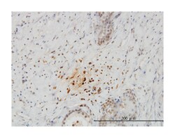 KiSS-1 metastasis-suppressor, Mouse, Clone: 1F7, Abnova&trade;