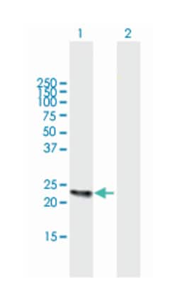 KLK2, Mouse, Polyclonal Antibody, Abnova 50&mu;L; Unlabeled:Antibodies,