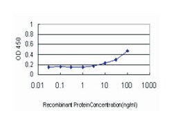 SMAD family member 4, Mouse, Clone: 3E2, Abnova 100&mu;g; Unlabeled:Antibodies,