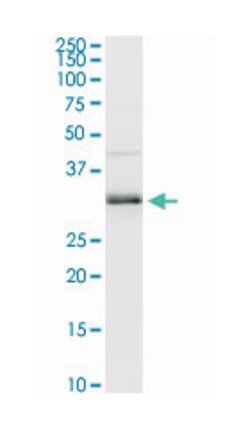 melanoma antigen family A, 9, Rabbit, Purified MaxPab Polyclonal Antibody,