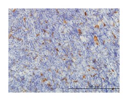 malic enzyme 1, NADP(+)-dependent, cytosolic, Mouse, Clone: 3H5, Abnova